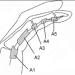 Pulley Rupture (tambin versin en espaol)